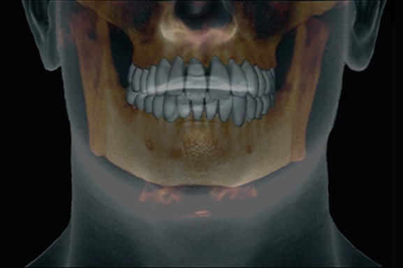 얼굴 뼈·치아 3D CT 영상